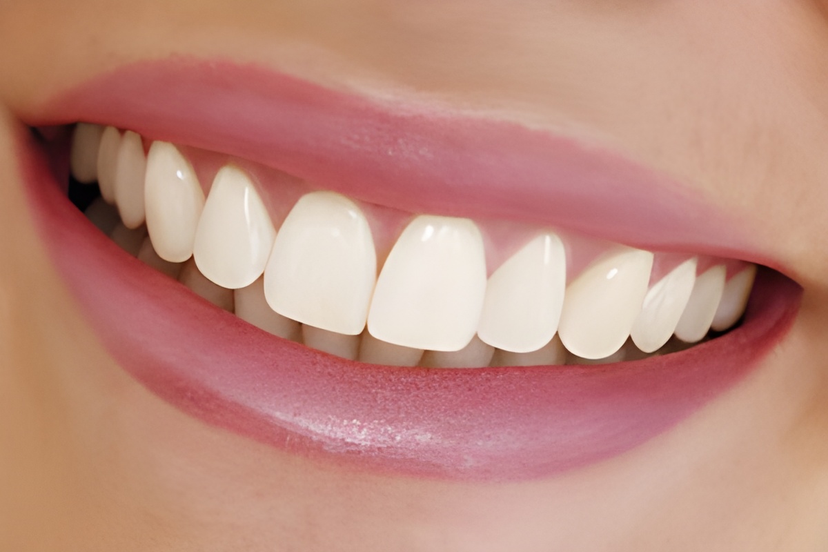 smile with zirconia dental crown