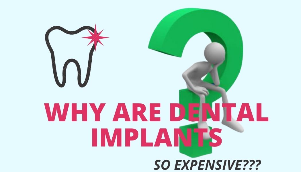 why implants are so expensive